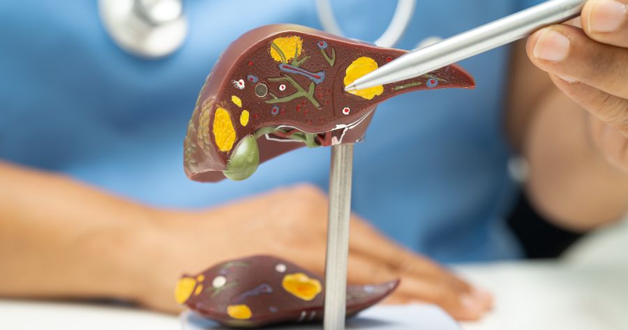 Álcool e Drogas 6 cirrose